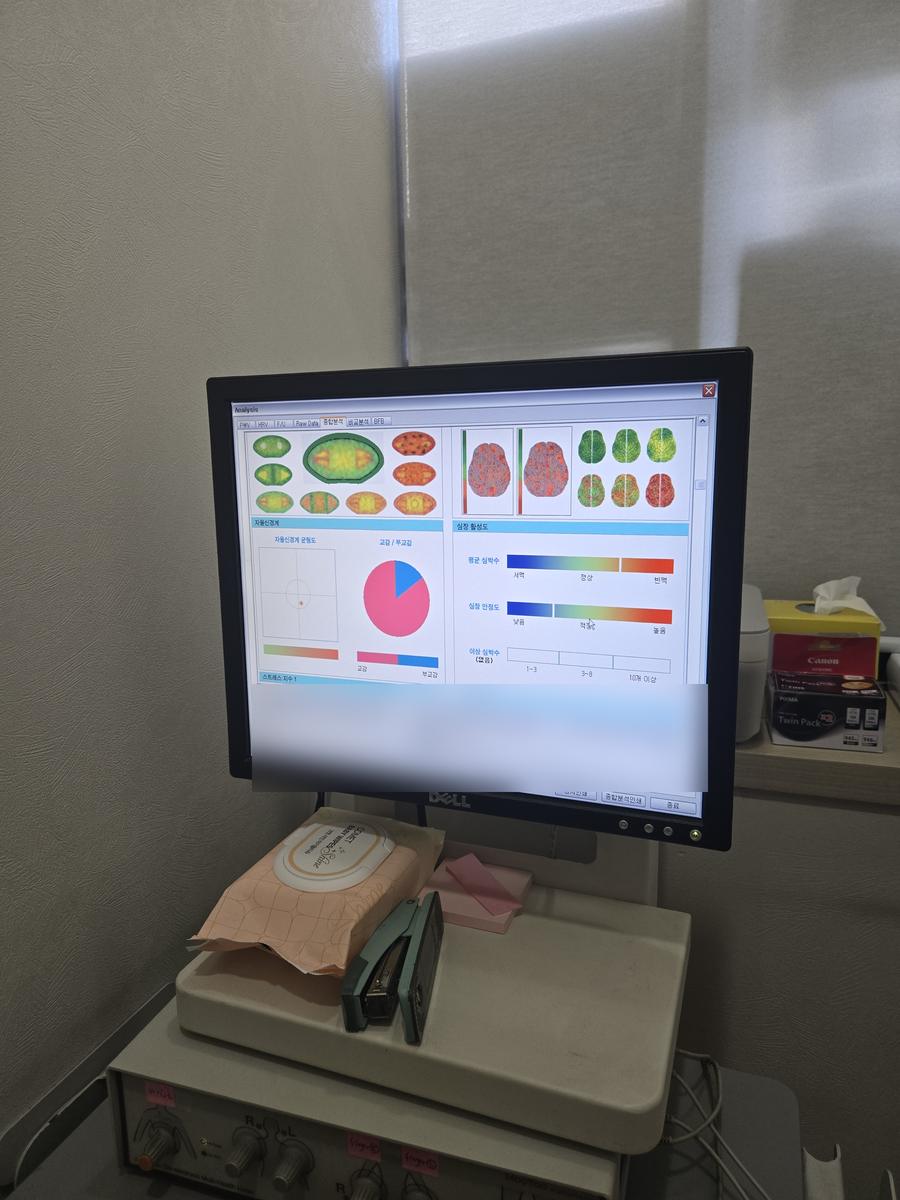 자율신경 검사 장비