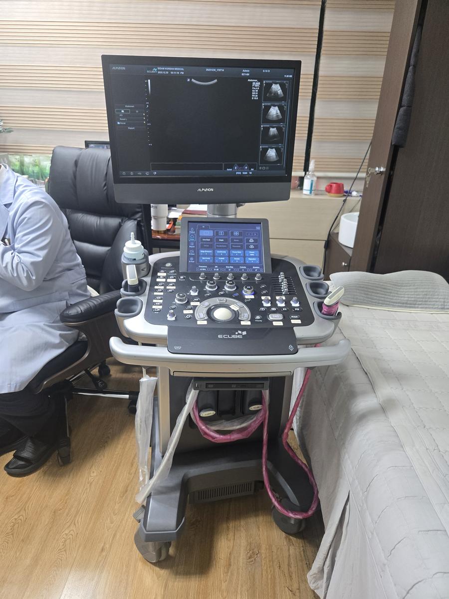 복부 초음파 장비